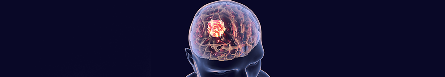 best brain tumor hospital in india